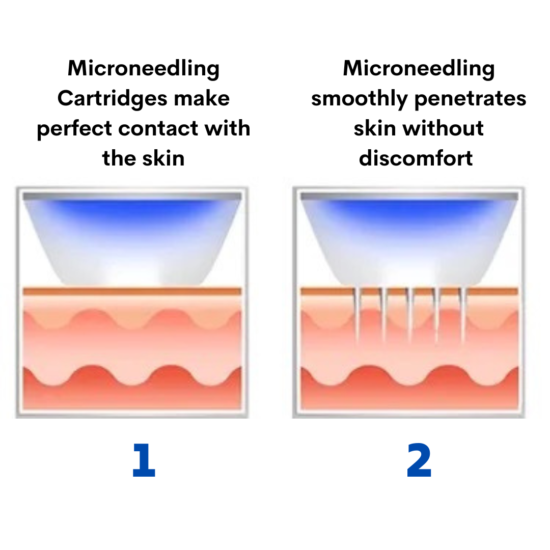 microneedling penetrates skin treatment 