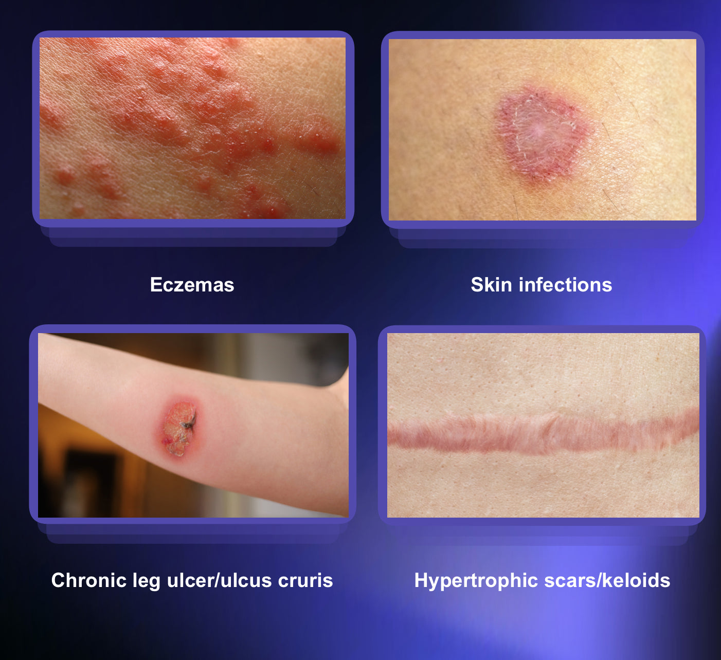 Máquina de Plasma Frío y Caliente Multifuncional PlasmaMax Pro 8D