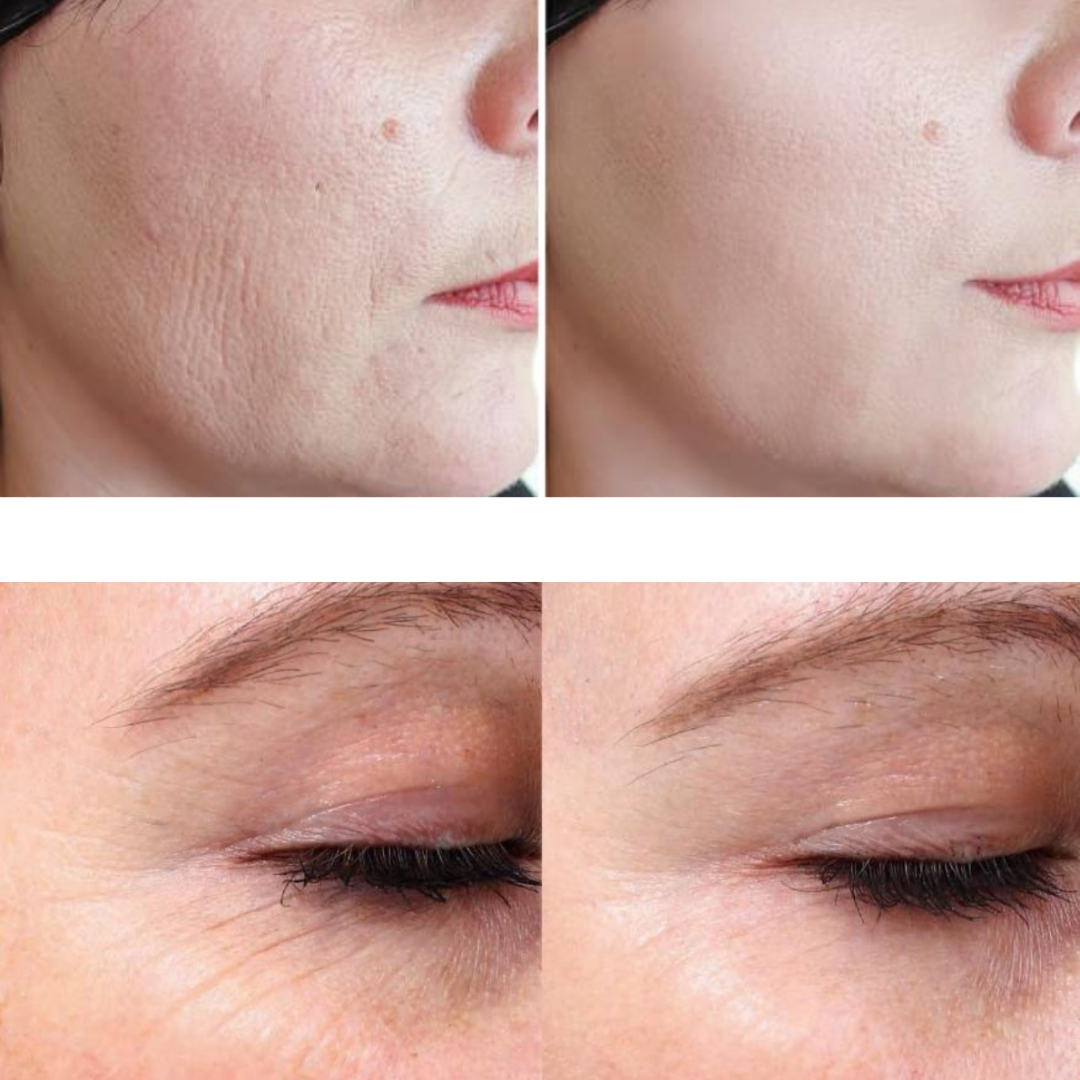 Eris® Lipo Cavitation Machine 9 in 1 Professional