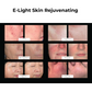 Sistema de rejuvenecimiento de la piel DermaLaze con IPL SHR y E-Light