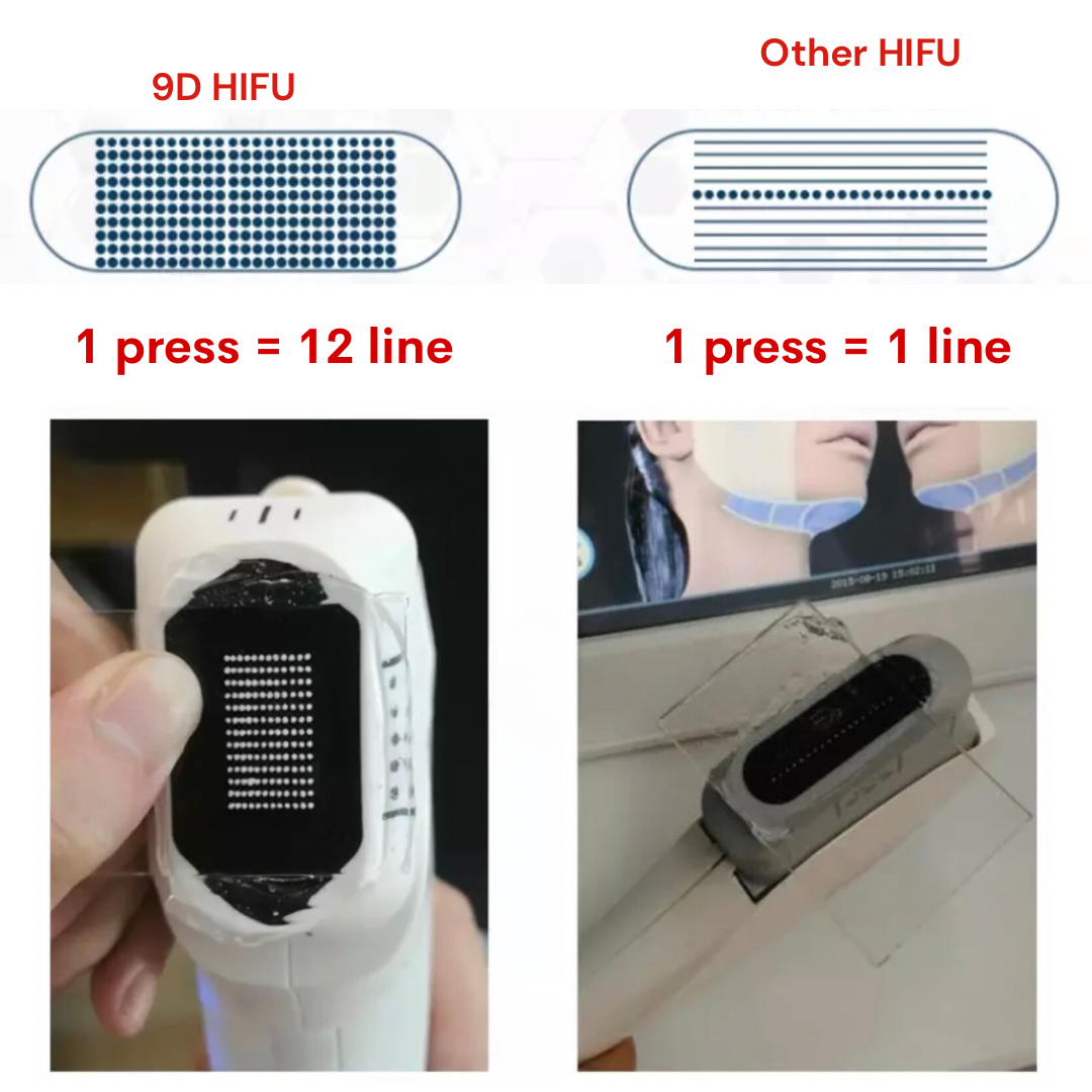 Replacement Cartridge for 9D Face Lifting HIFU Machine