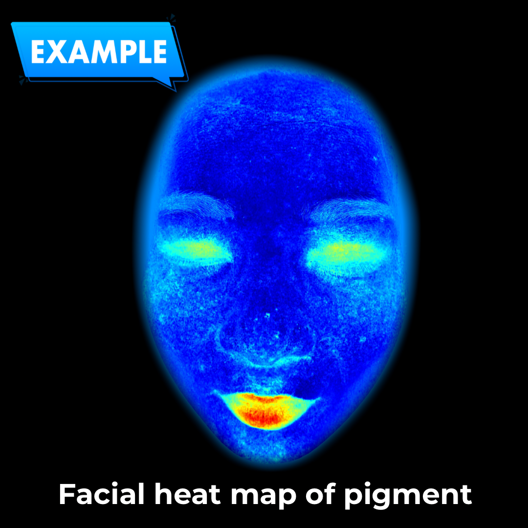 Système d'Analyse de Peau Audit-Face™
