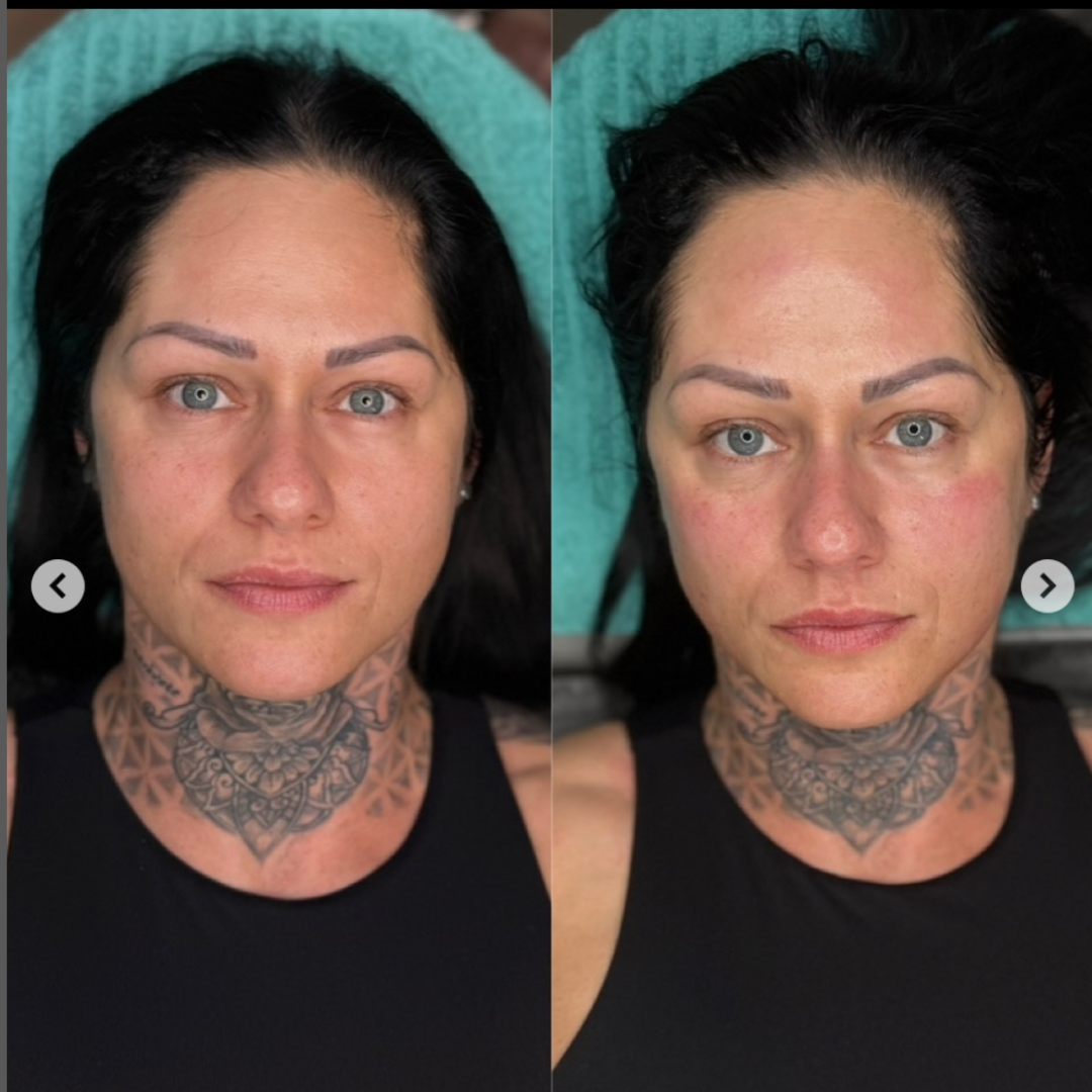 Profesional PERFECT SHAPE® NEO PLUS (Cuerpo y Rostro)