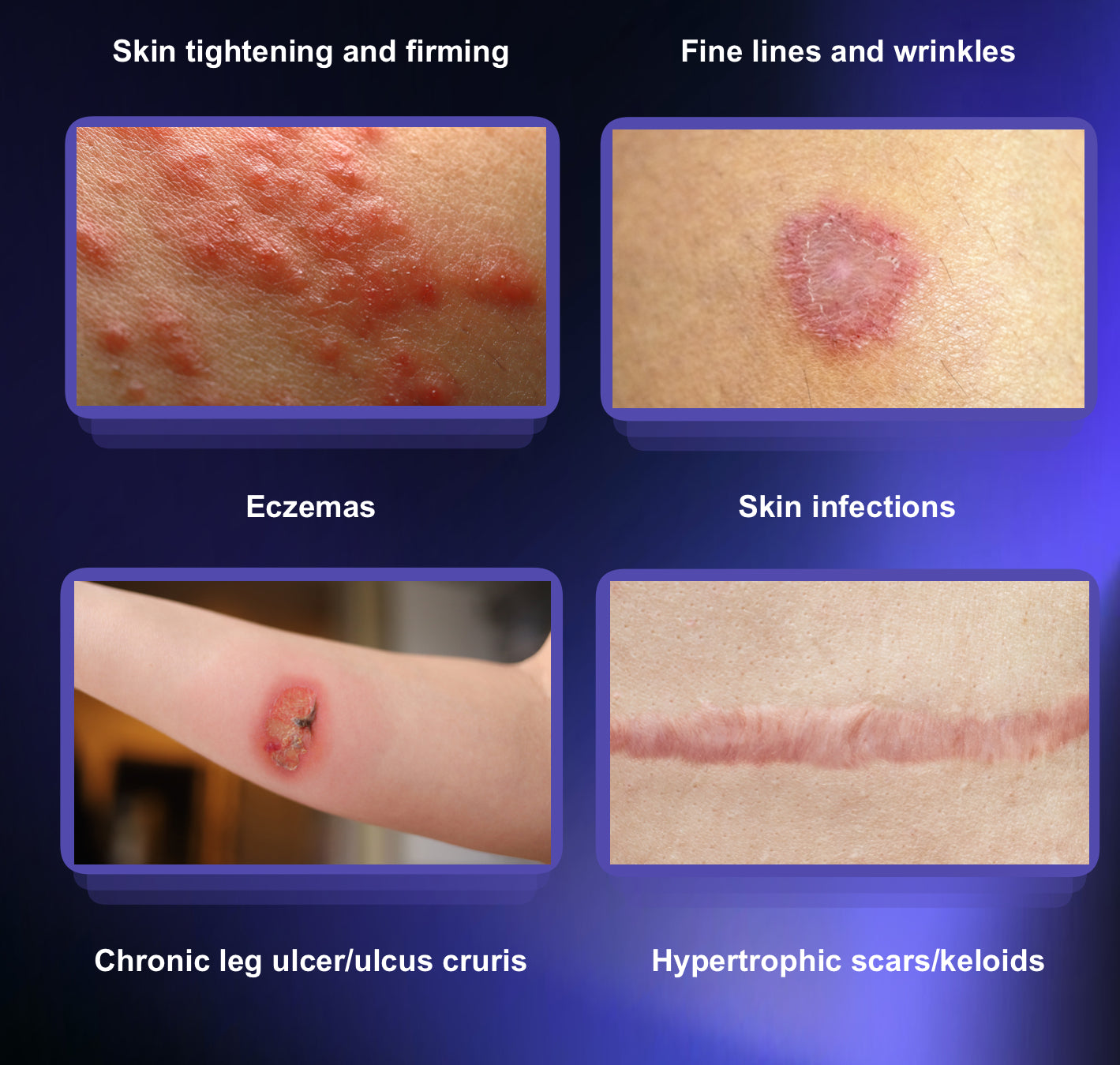 Máquina de Plasma Frío y Caliente Multifuncional PlasmaMax Pro 8D