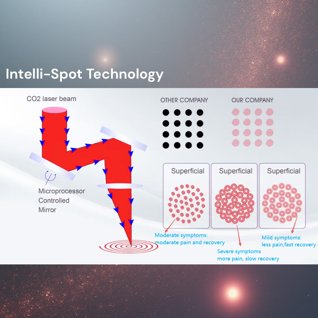 CarbonFrax™ Pro Láser Fraccional de CO2