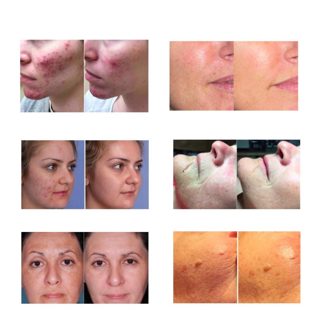 Light Goddess PRO Revitalisant thérapeutique pour la peau