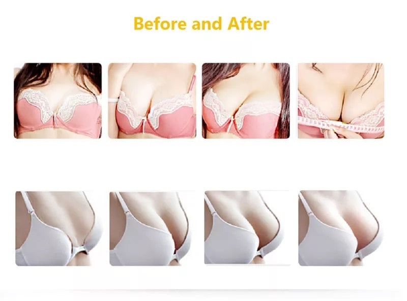 Woman’s Breasts, before and after using Vacuum Therapy Machine with XXLCups