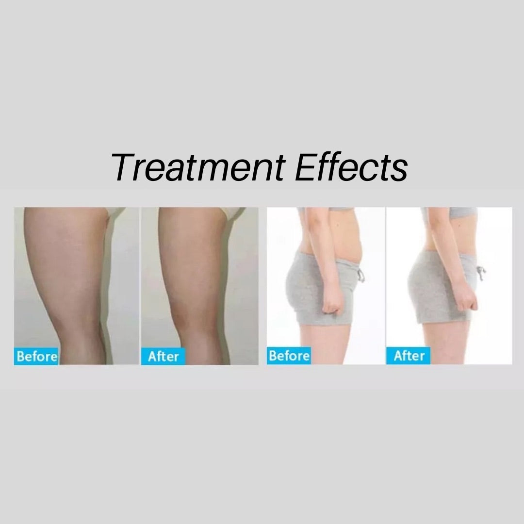 treatment effects