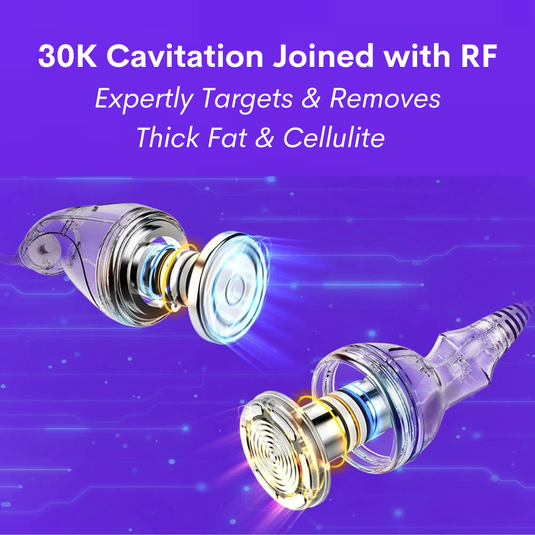 30K cavitation with RF, handle inner workings