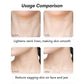 Usage comparison of neck skin, before and after using led neck massager beauty device