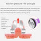 Vacuum Pressure plus RF Principle of Unoisetion Cavitation Machine 