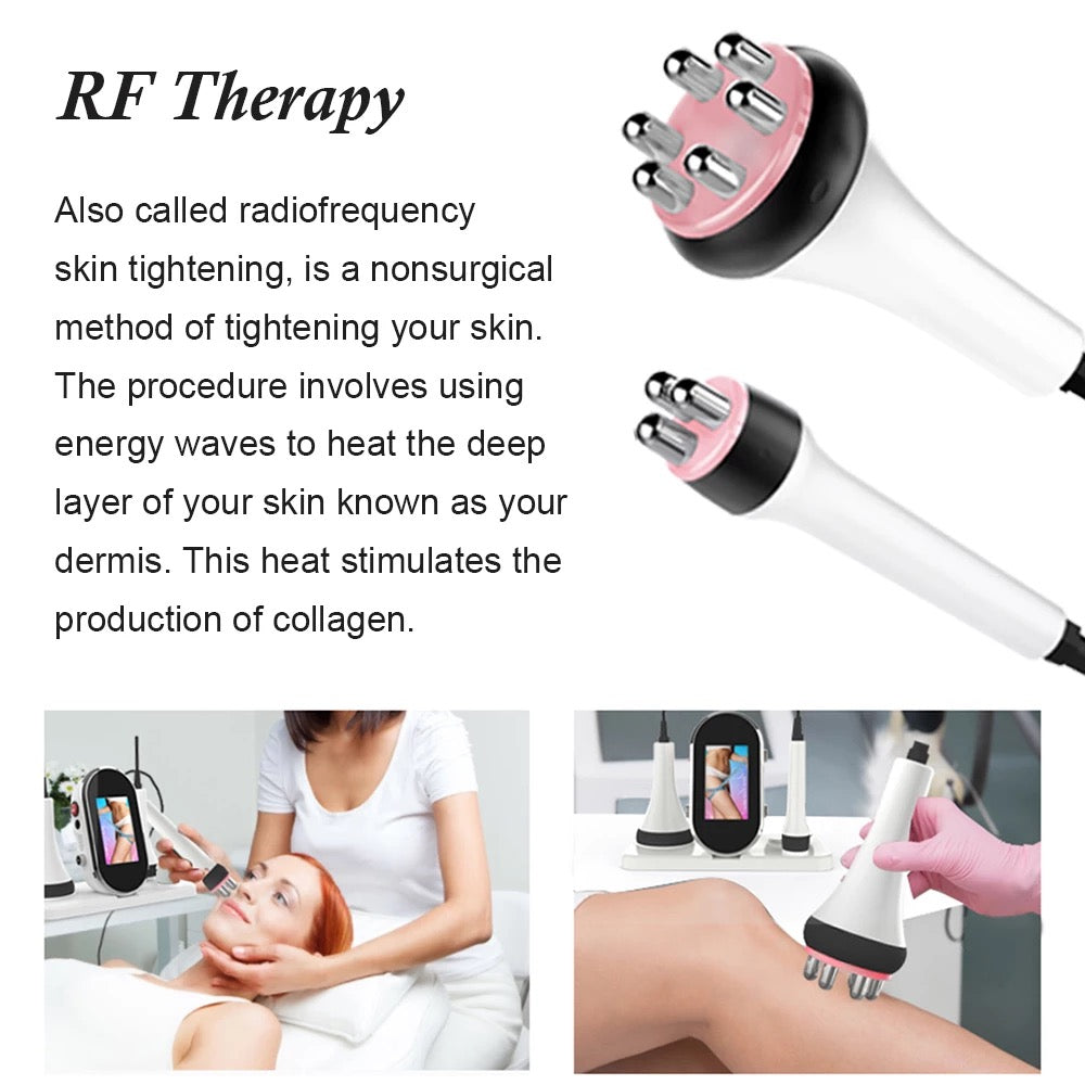RF skin tightening therapy 
