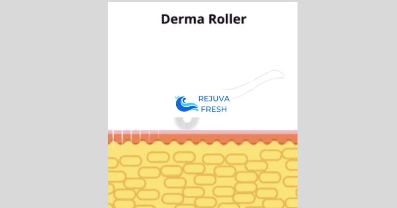 Derma Roller Microneedle Device Facial Device