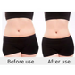Before and After using Lipo cavitation Machine on Stomach area