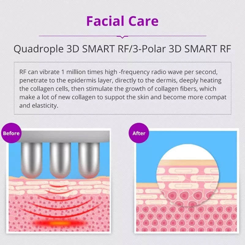 Facial Care, Before and After, RF Unoisetion Cavitation Machine 
