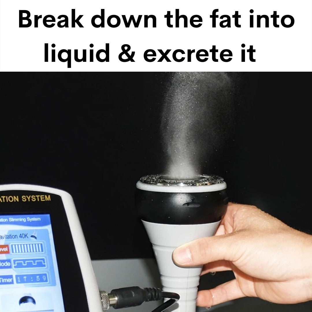 40k Cavitation Machine Probe breaks down the fat into liquid and excretes it