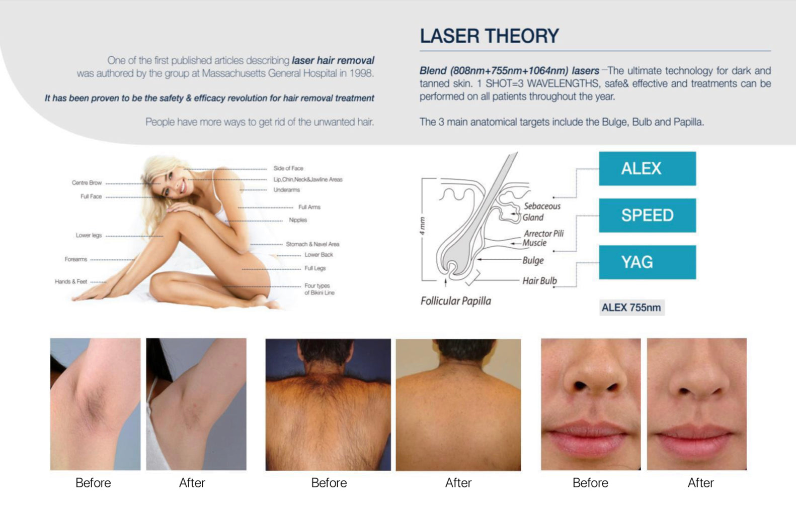laser theory with 3 wavelengths, woman with smooth skin, body parts before and after treatment.
