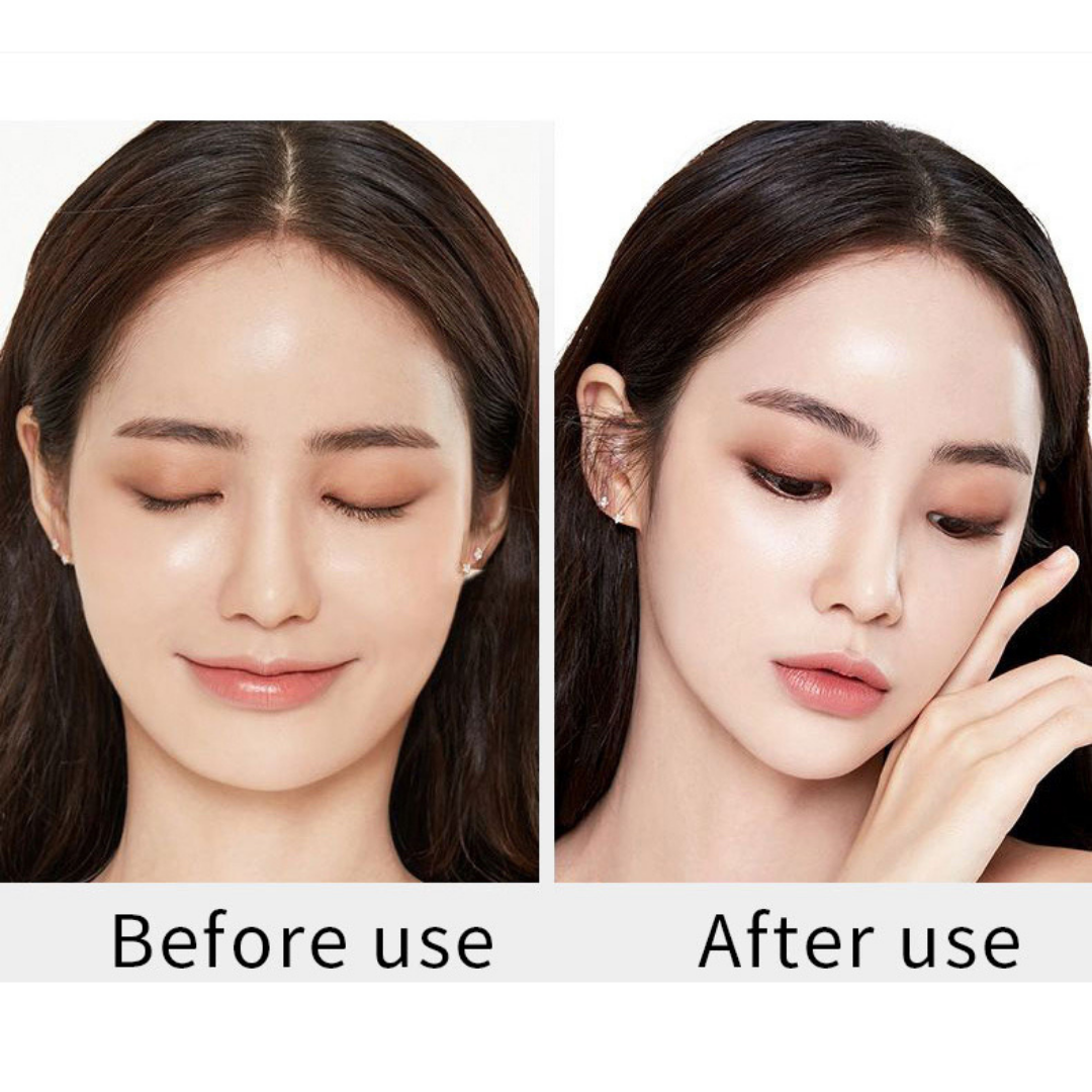 Young Woman’s Facial Skin Condition before and after using RF Beauty Device 