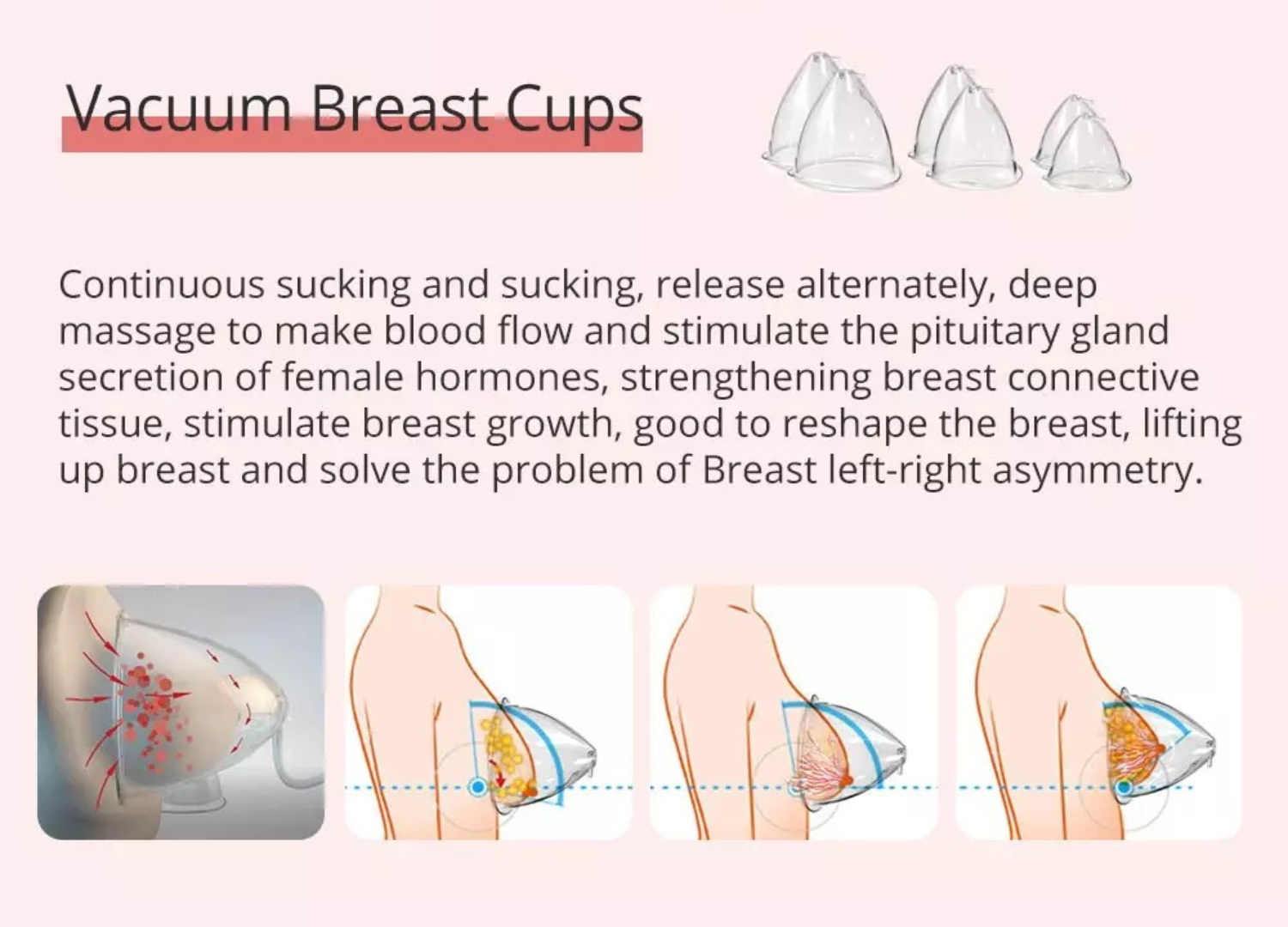 Vacuum Breast Cups, used on woman’s Chest with continuous sucking