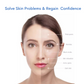 Beautiful Skin Side of Face versus Problem Skin Side of Face, Solve Skin Problems and Regain Confidence
