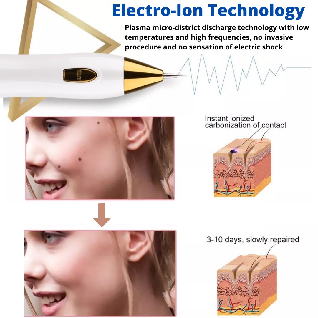 Electro ion technology of plasma pen  removes skin tags and spots