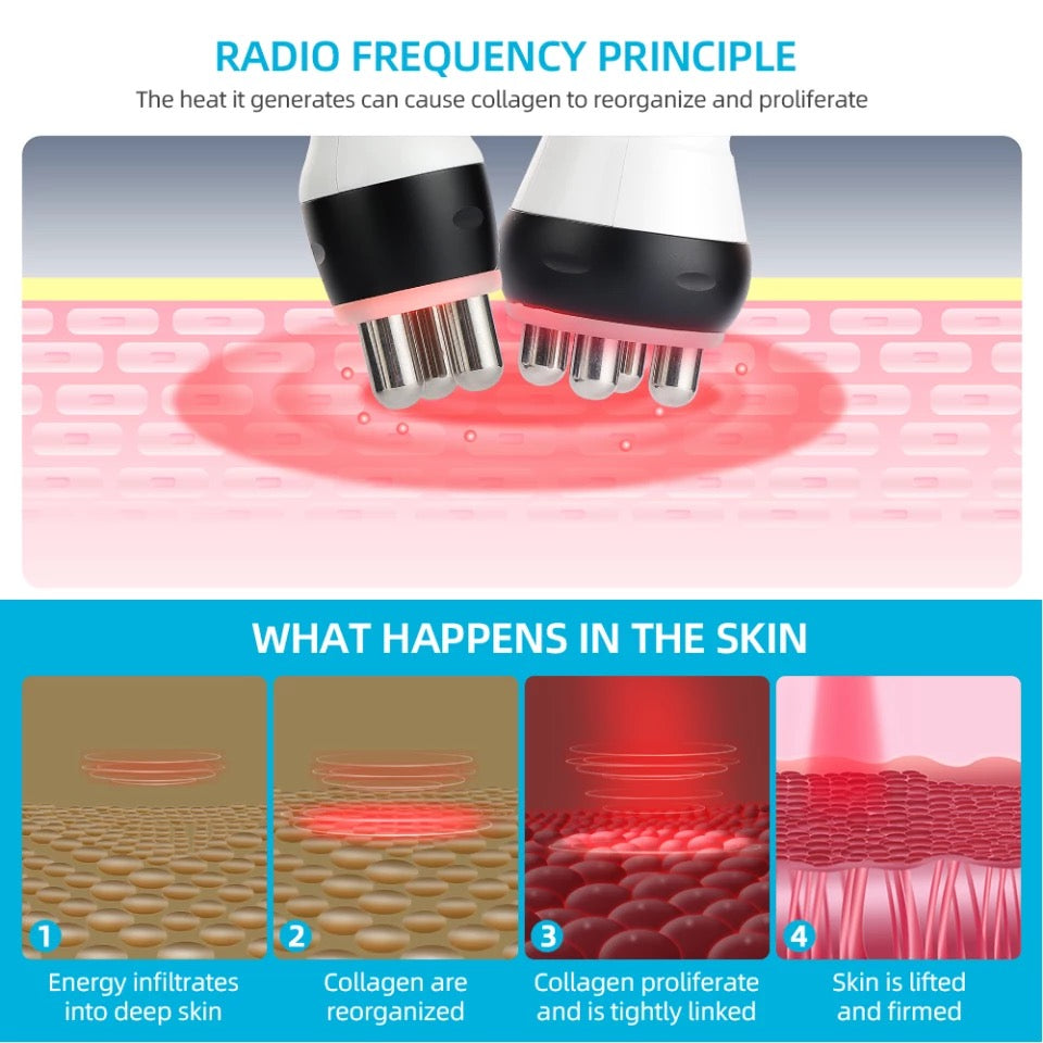 Radio Frequency Skin Tightening Principle, What happens to the Skin during treatment 