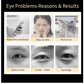 Eye Problems Reasons and Results 