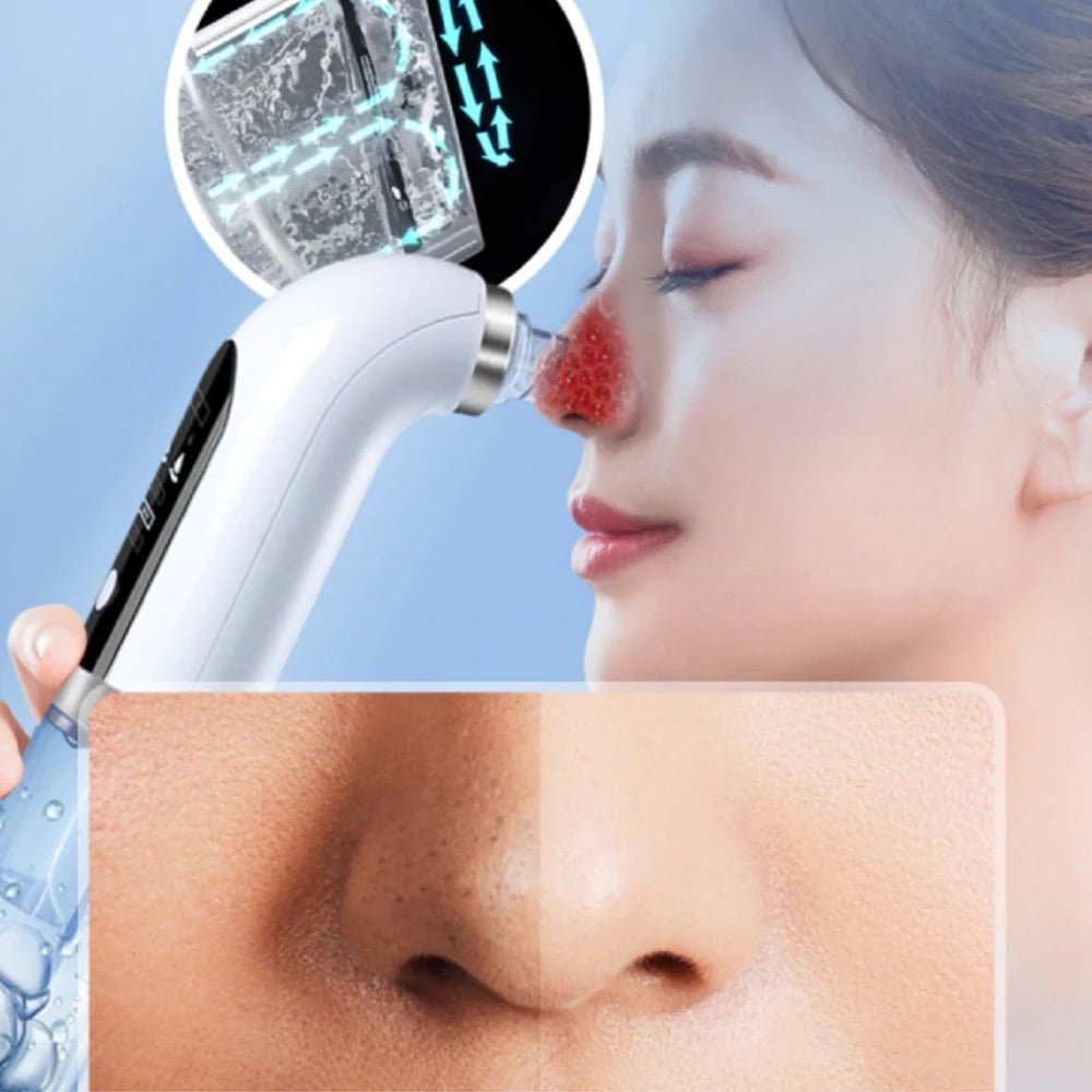 Super Micro Bubble Blackhead Remover Facial Device