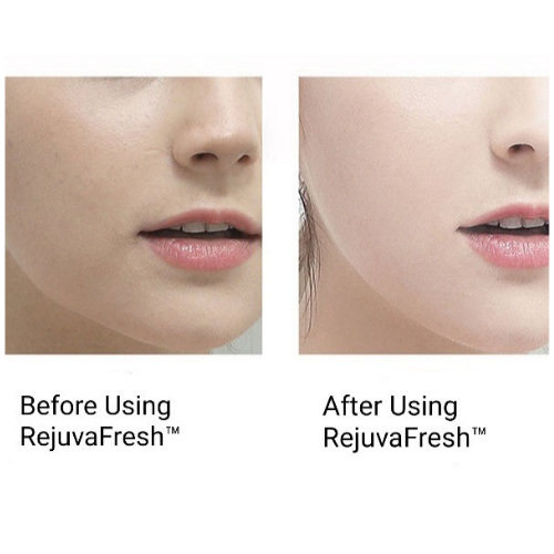 Skin on Face Before and After using Rejuva Fresh Sonic Exfoliating Wand Facial Device